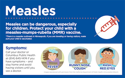 Measles Symptoms